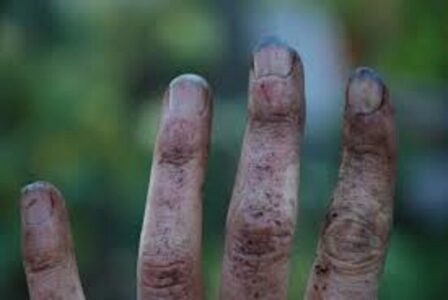 Gardening to Treat the Mind, Body, and Soul Image